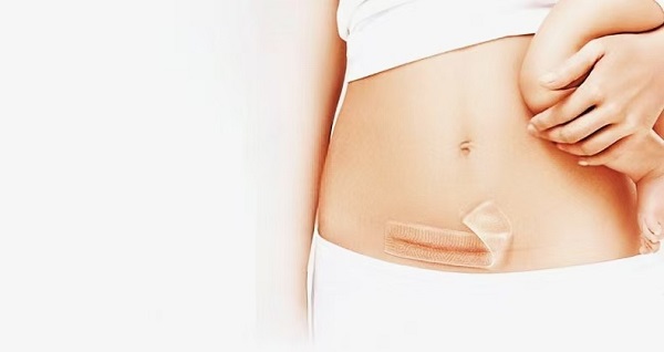 Почему толстые силиконовые гель-листы от шрамов так популярны?