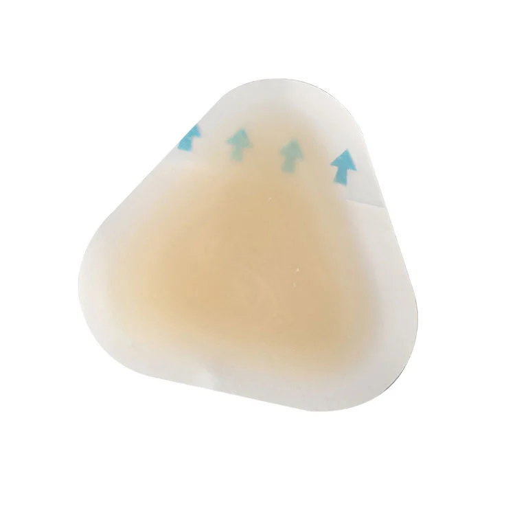 Профилактика стерильных волдырей на пятках: как защитить ноги от боли, инфекции и повреждений от трения